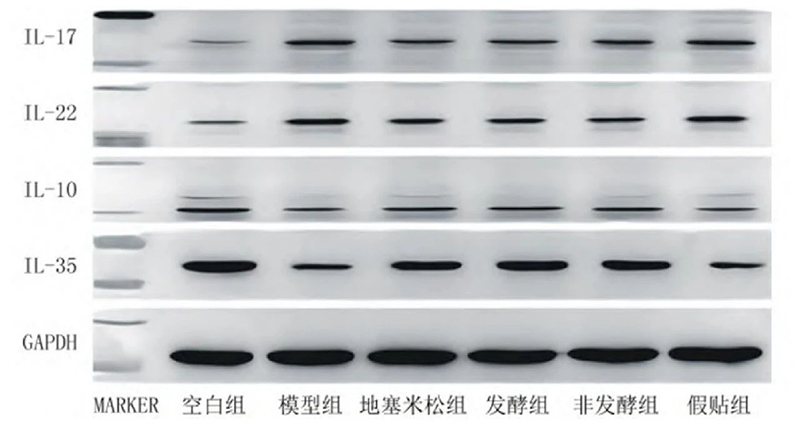 空白组和支气管哮喘各组大鼠肺组织中IL－17、IL－22、IL－10、IL－35蛋白表达电泳图